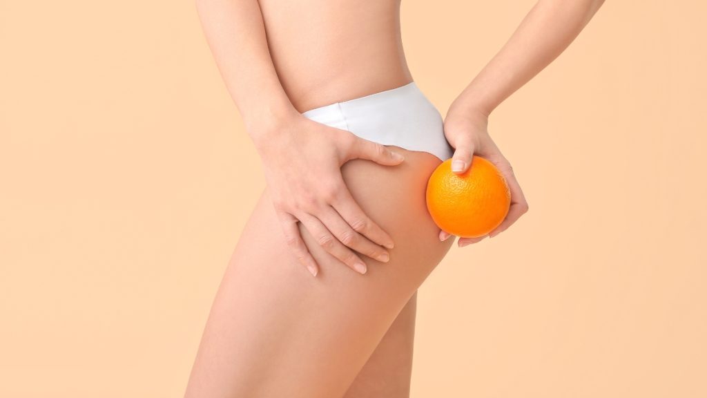 女性に多いセルライトは「オレンジピール」と呼ばれる